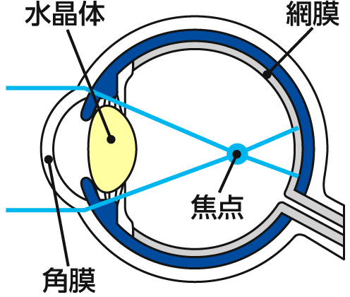 近視の状態